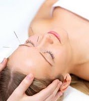 Facial acupuncture